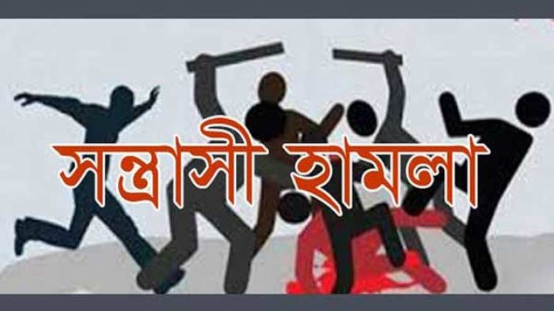 গাজীপুরে সাংবাদিক আনোয়ার হোসেনের উপর সন্ত্রাসী হামলা।