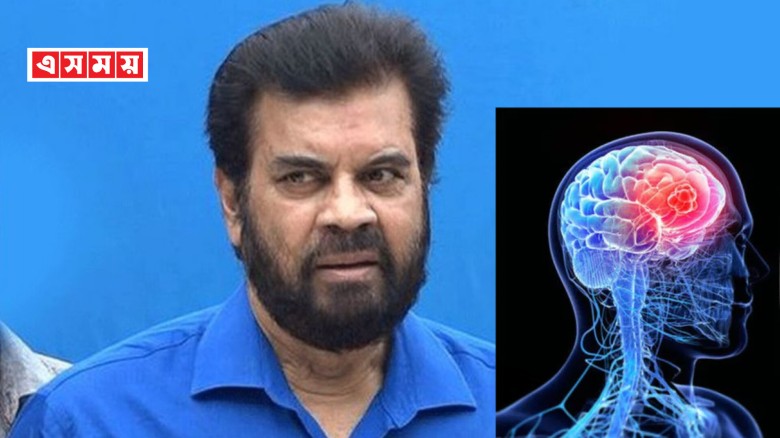 ইলিয়াস কাঞ্চনের ব্রেন টিউমার ধরা পড়েছে