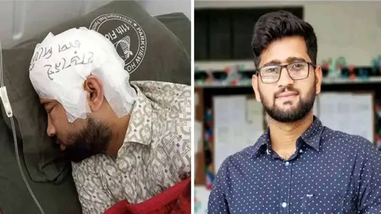 দুই মাস পর আহত চবি শিক্ষার্থী মামুনের মাথার খুলি প্রতিস্থাপন।...